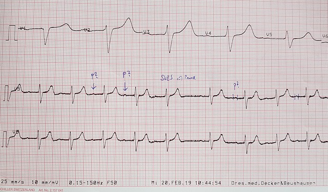 doktorekg_holter ciśnieniowy 2.jpg